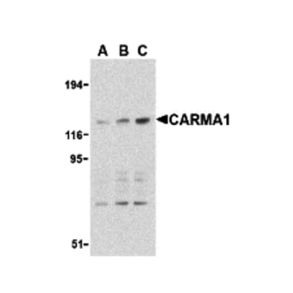 ProSci 3189 CARMA1 Antibody, ProSci, 0.1 mg/Unit Primary Image