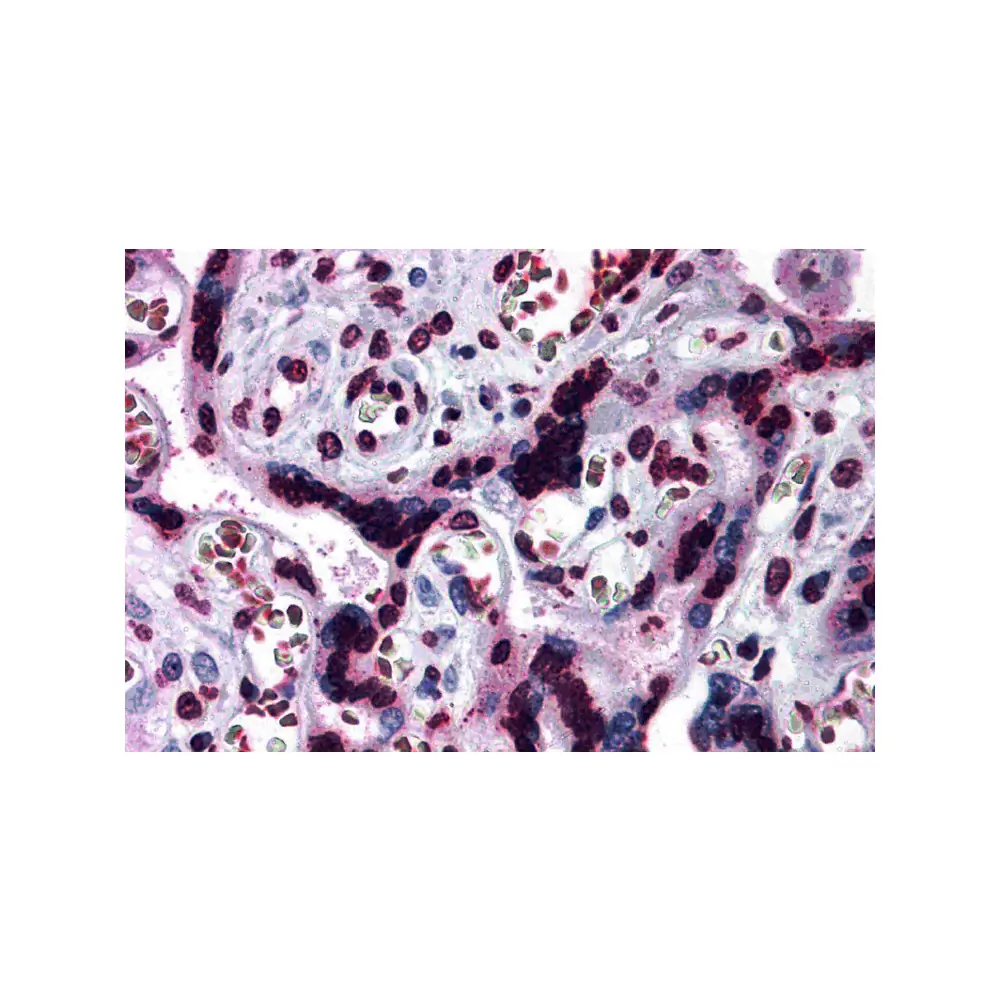 ProSci 3191 CARMA2 Antibody, ProSci, 0.1 mg/Unit Primary Image