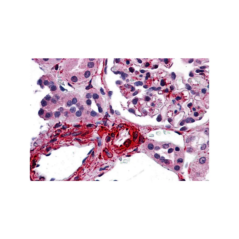 ProSci 3193 CARMA3 Antibody, ProSci, 0.1 mg/Unit Primary Image