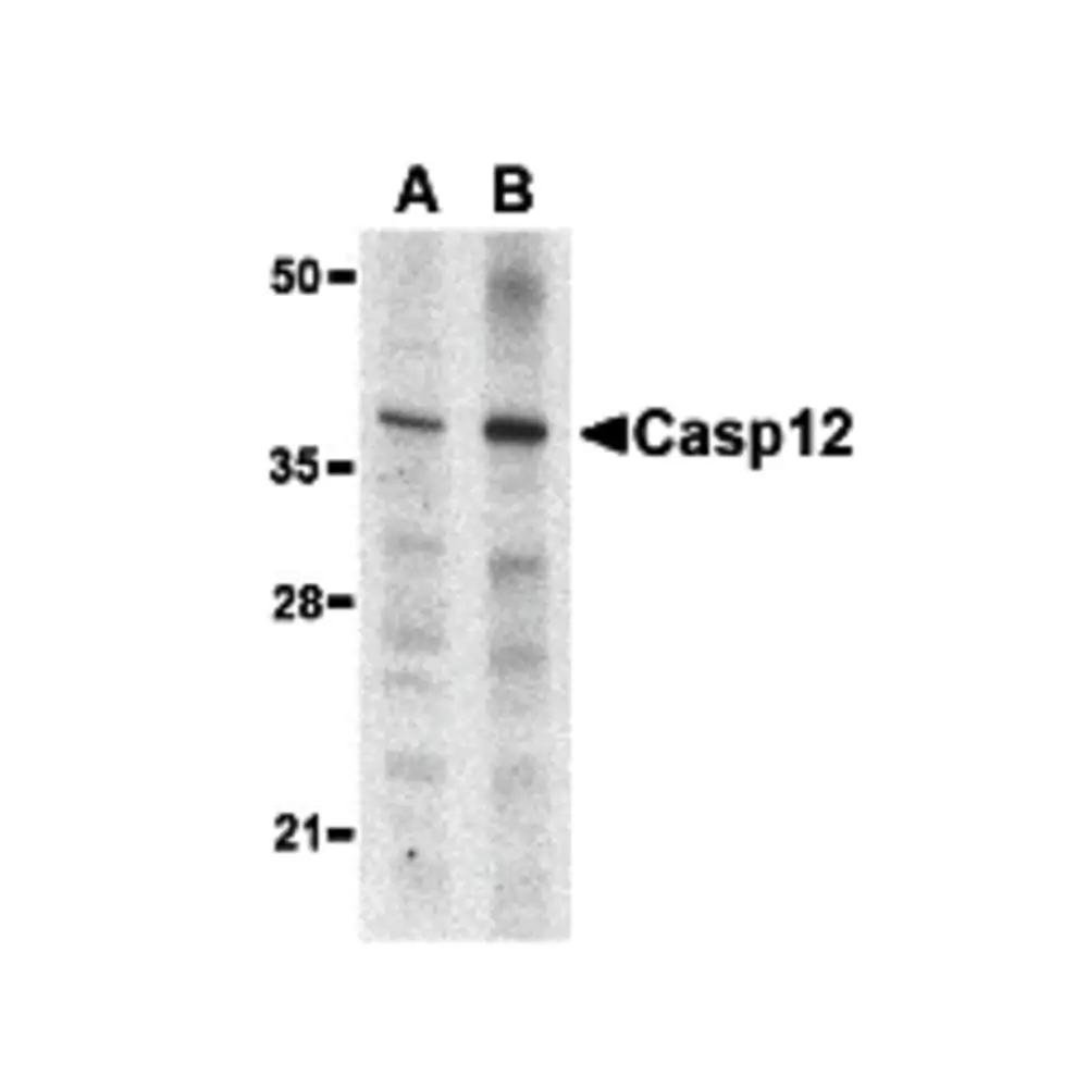 ProSci 3197 Caspase-12 Antibody (Small), ProSci, 0.1 mg/Unit Primary Image