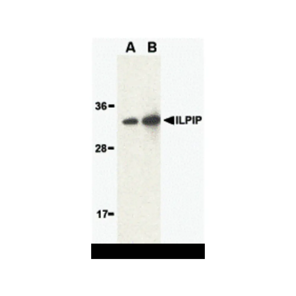 ProSci 3199 ILPIP Antibody, ProSci, 0.1 mg/Unit Primary Image