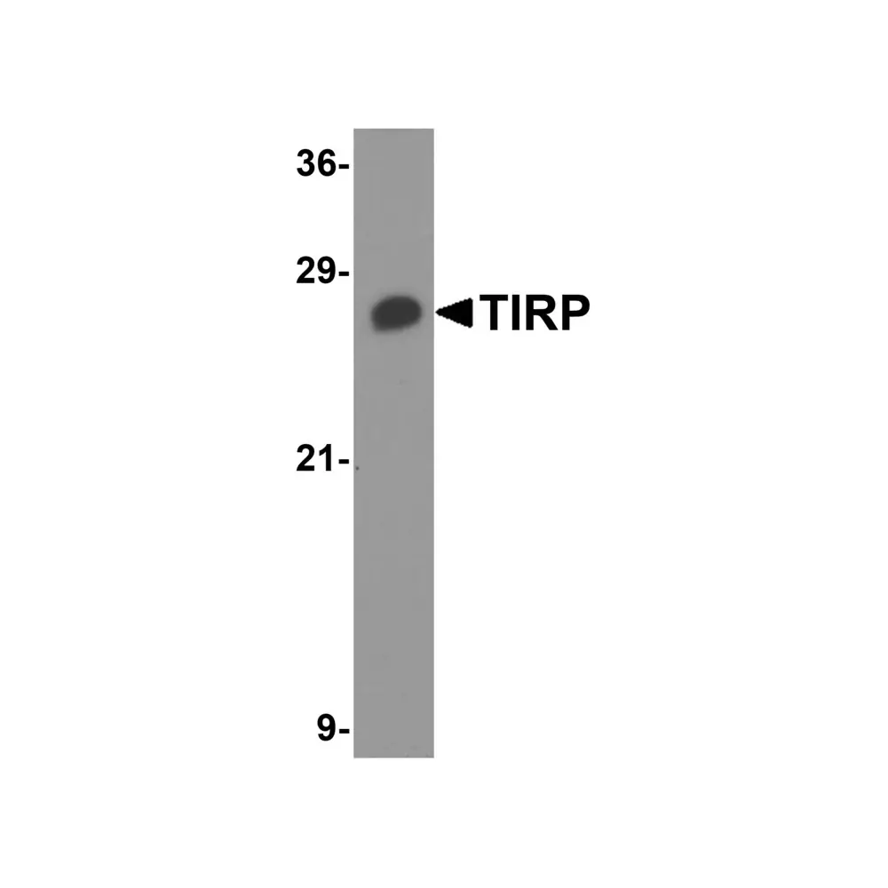 ProSci 3206 TIRP Antibody, ProSci, 0.1 mg/Unit Primary Image