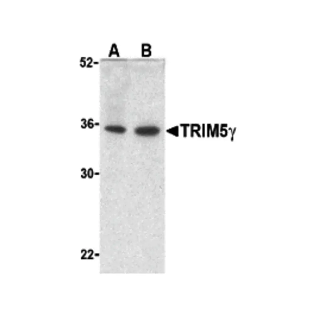 ProSci 3239 TRIM5 gamma Antibody, ProSci, 0.1 mg/Unit Primary Image