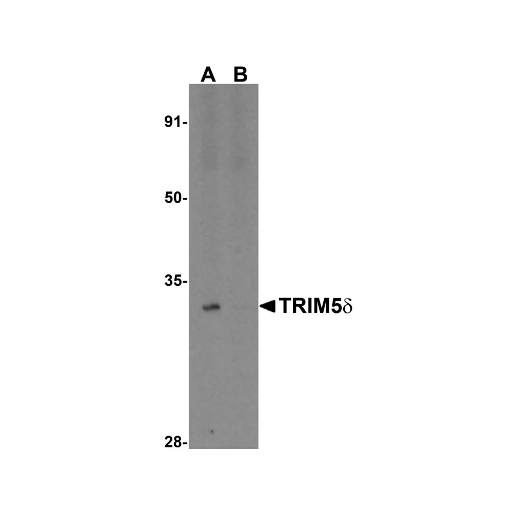 ProSci 3241 TRIM5 delta Antibody, ProSci, 0.1 mg/Unit Primary Image