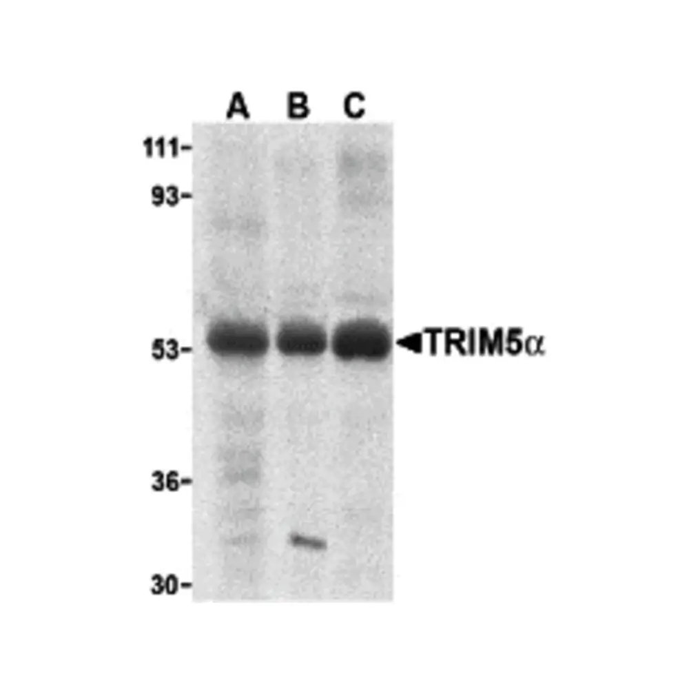 ProSci 3247 TRIM5 alpha Antibody, ProSci, 0.1 mg/Unit Primary Image