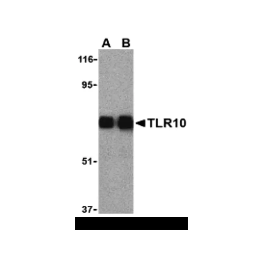 ProSci 3275_S TLR10 Antibody, ProSci, 0.02 mg/Unit Primary Image
