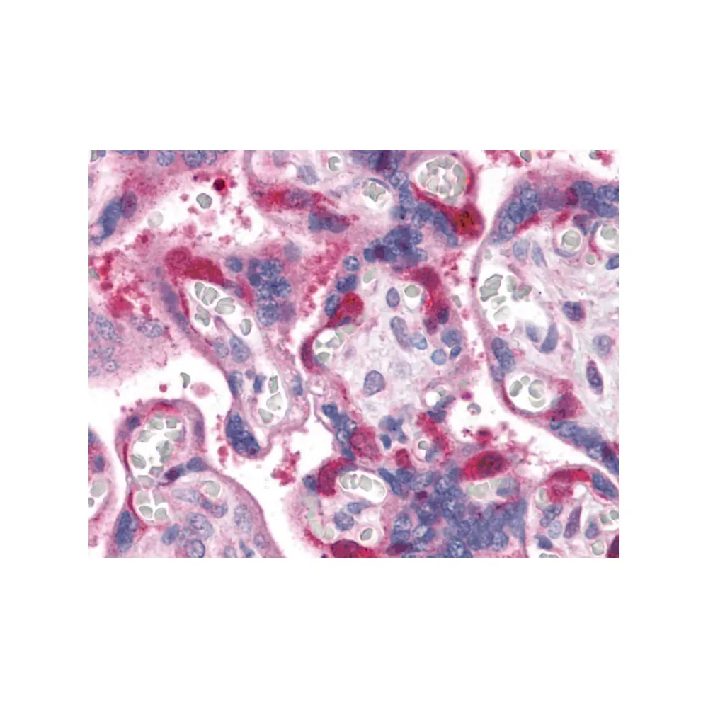 ProSci 3291_S RIPK1 Antibody, ProSci, 0.02 mg/Unit Primary Image