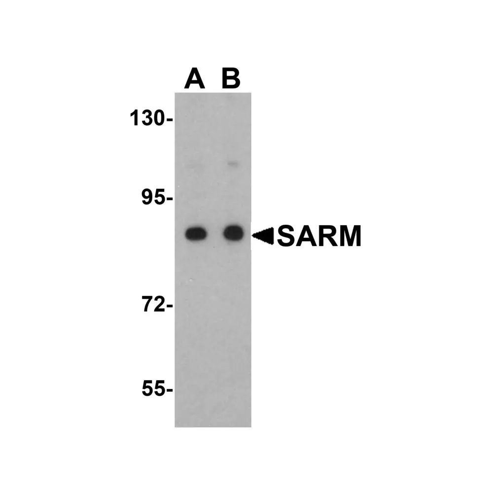 ProSci 3295 SARM Antibody, ProSci, 0.1 mg/Unit Primary Image