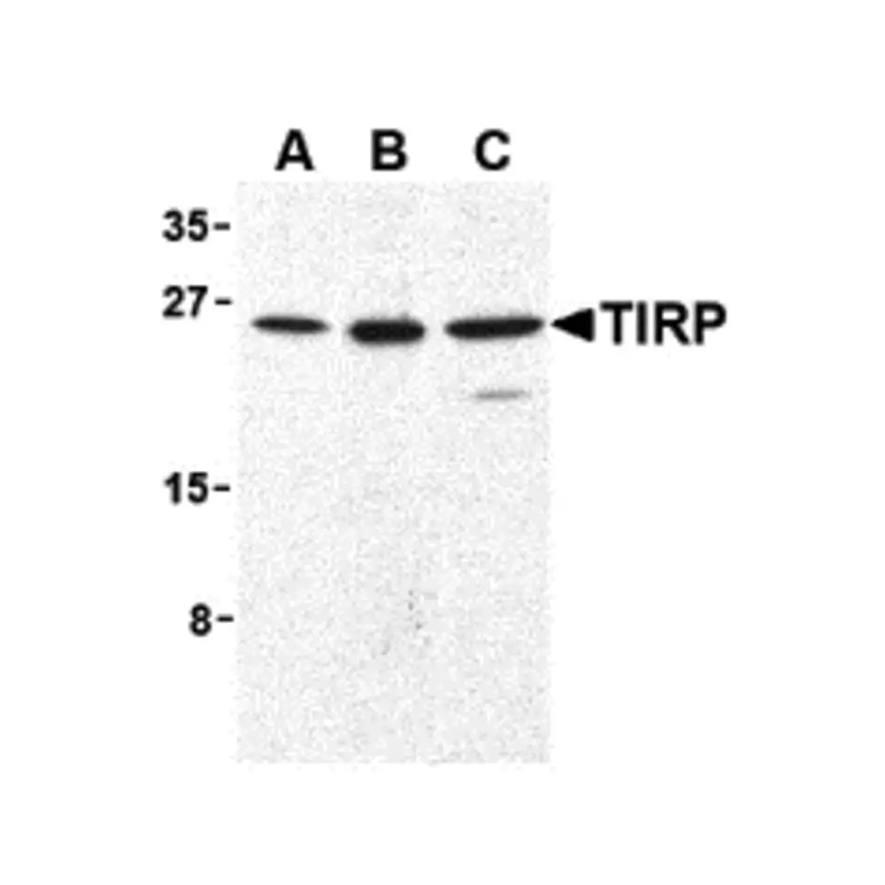 ProSci 3299 TIRP Antibody, ProSci, 0.1 mg/Unit Primary Image