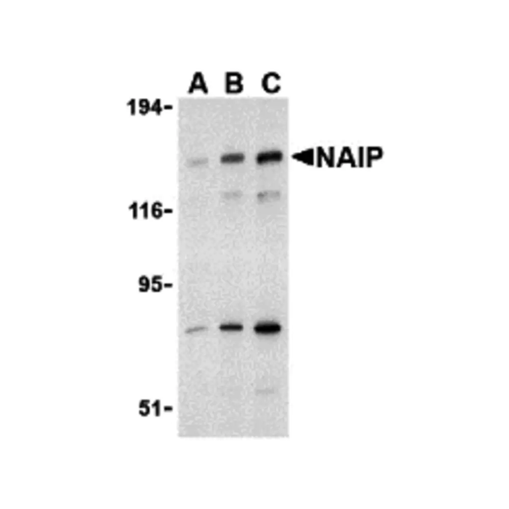 ProSci 3315_S NAIP Antibody, ProSci, 0.02 mg/Unit Primary Image