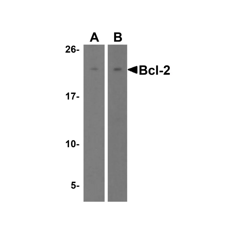 ProSci 3337_S Bcl-2 Antibody, ProSci, 0.02 mg/Unit Primary Image