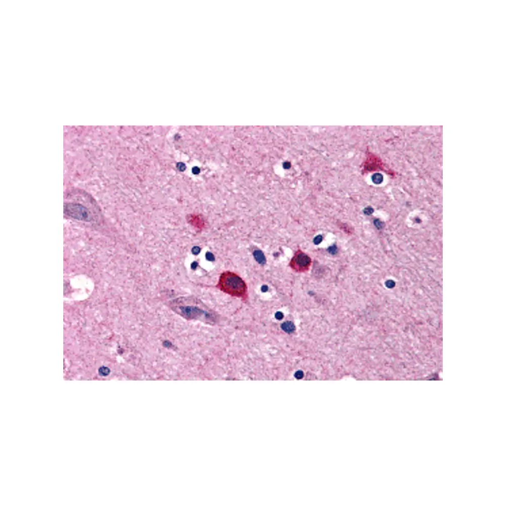 ProSci 3357 BOK Antibody, ProSci, 0.1 mg/Unit Primary Image