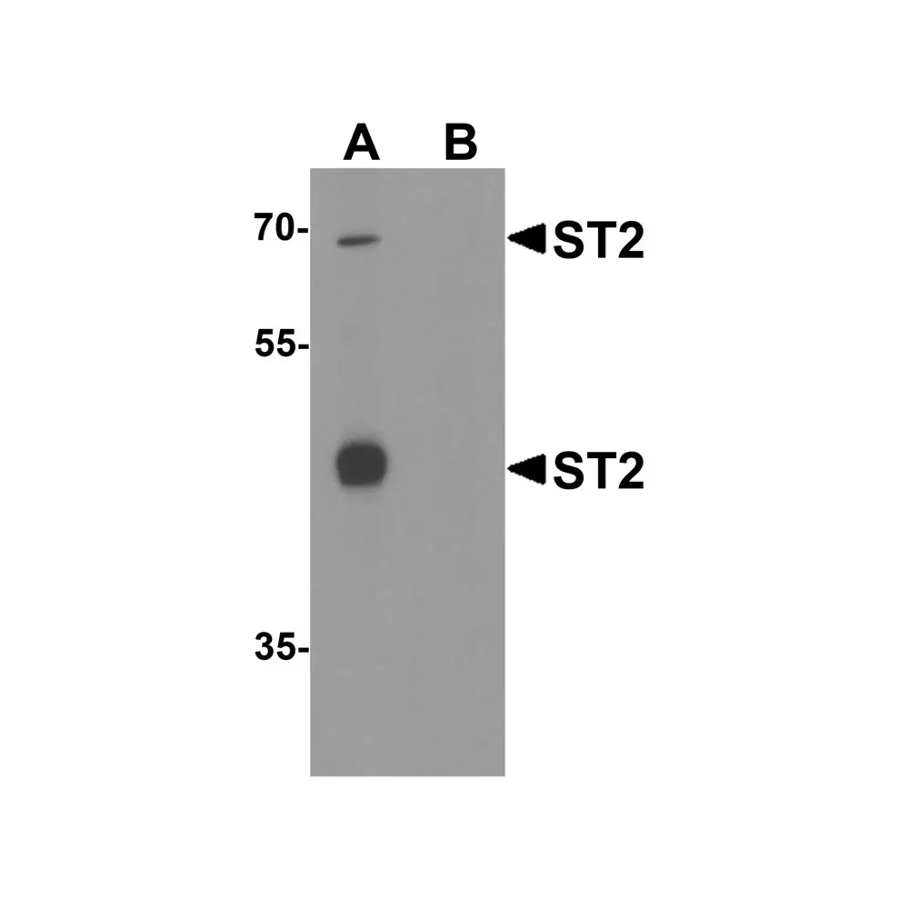 ProSci 3363 ST2 Antibody, ProSci, 0.1 mg/Unit Primary Image