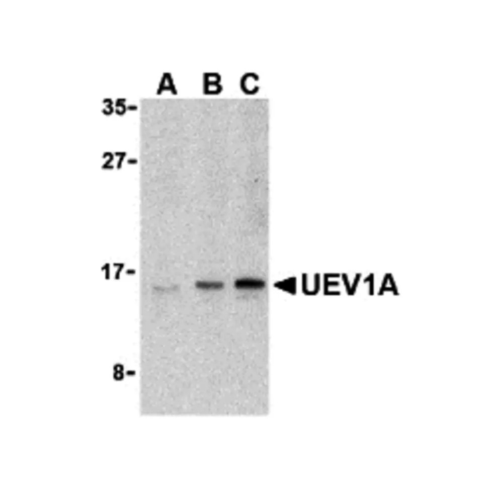 ProSci 3375 UEV1A Antibody, ProSci, 0.1 mg/Unit Primary Image