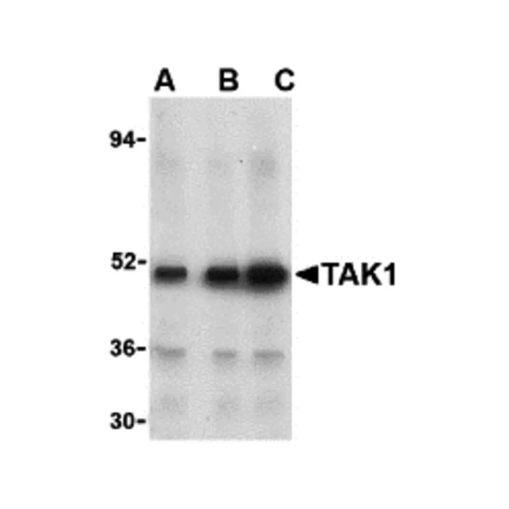 ProSci 3385 TAK1 Antibody, ProSci, 0.1 mg/Unit Primary Image