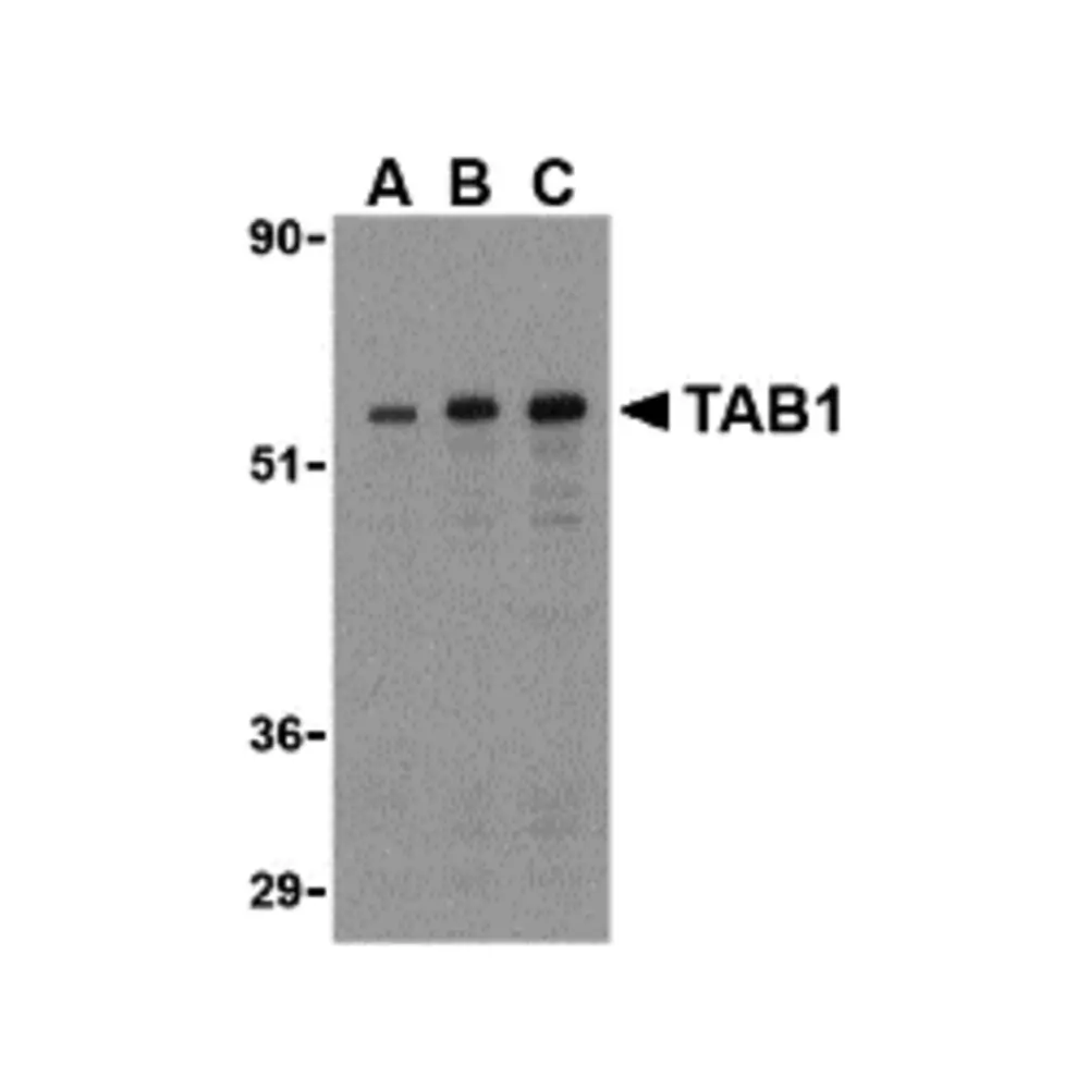 ProSci 3387 TAB1 Antibody, ProSci, 0.1 mg/Unit Primary Image
