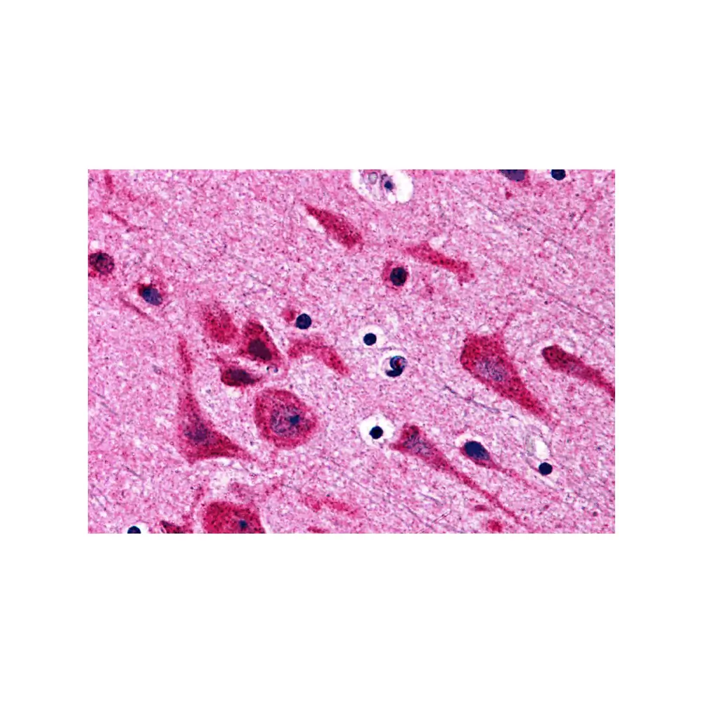 ProSci 3389_S TAB2 Antibody, ProSci, 0.02 mg/Unit Primary Image