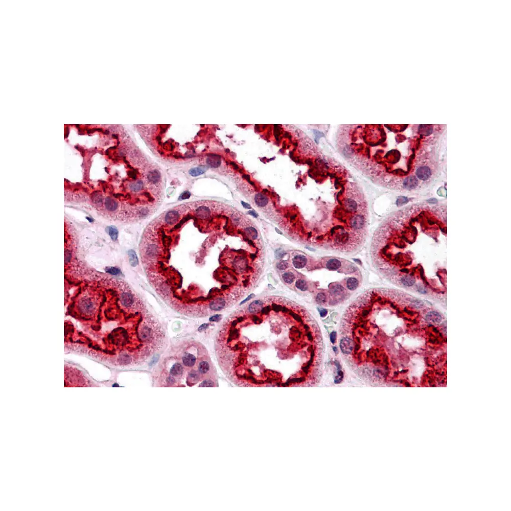 ProSci 3391 TAB3 Antibody, ProSci, 0.1 mg/Unit Primary Image