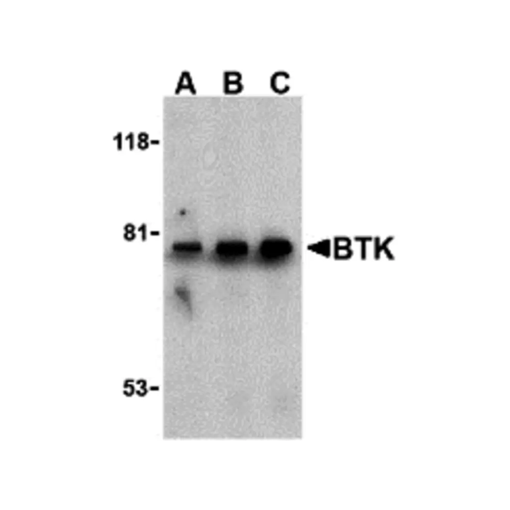 ProSci 3395 BTK Antibody, ProSci, 0.1 mg/Unit Primary Image