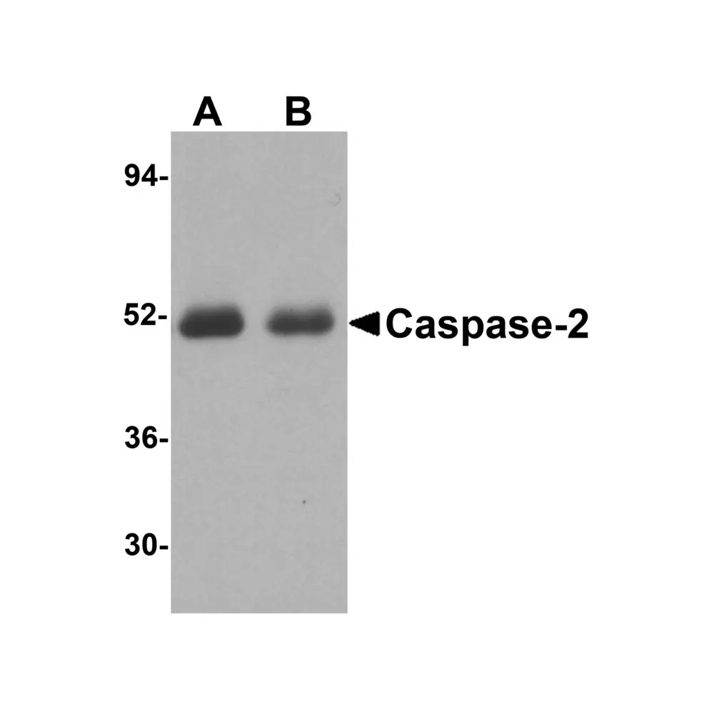 ProSci 3447_S Caspase-2 Antibody, ProSci, 0.02 mg/Unit Primary Image