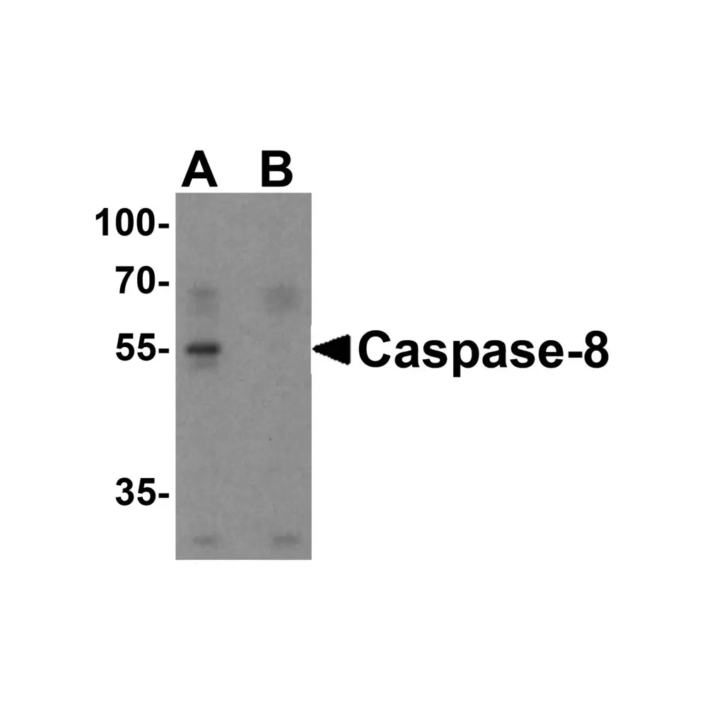 ProSci 3473 Caspase-8 Antibody, ProSci, 0.1 mg/Unit Primary Image