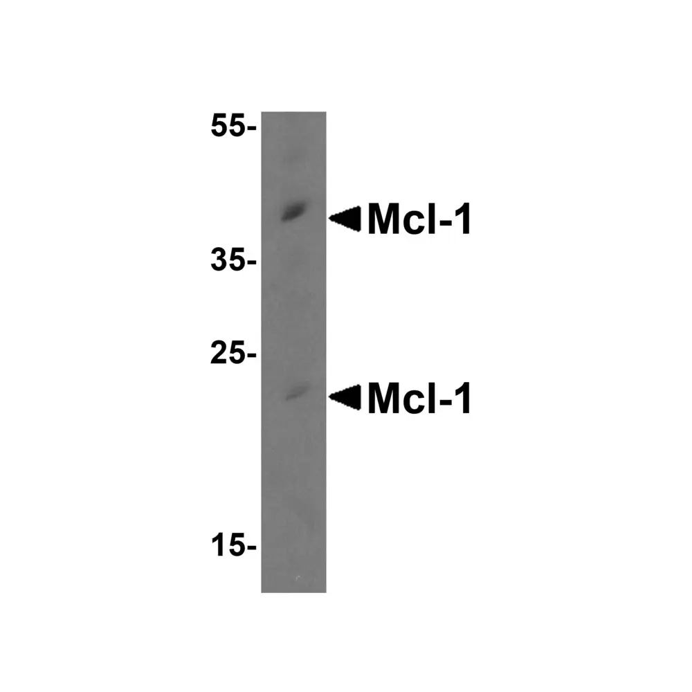 ProSci 3477 Mcl-1 Antibody, ProSci, 0.1 mg/Unit Primary Image