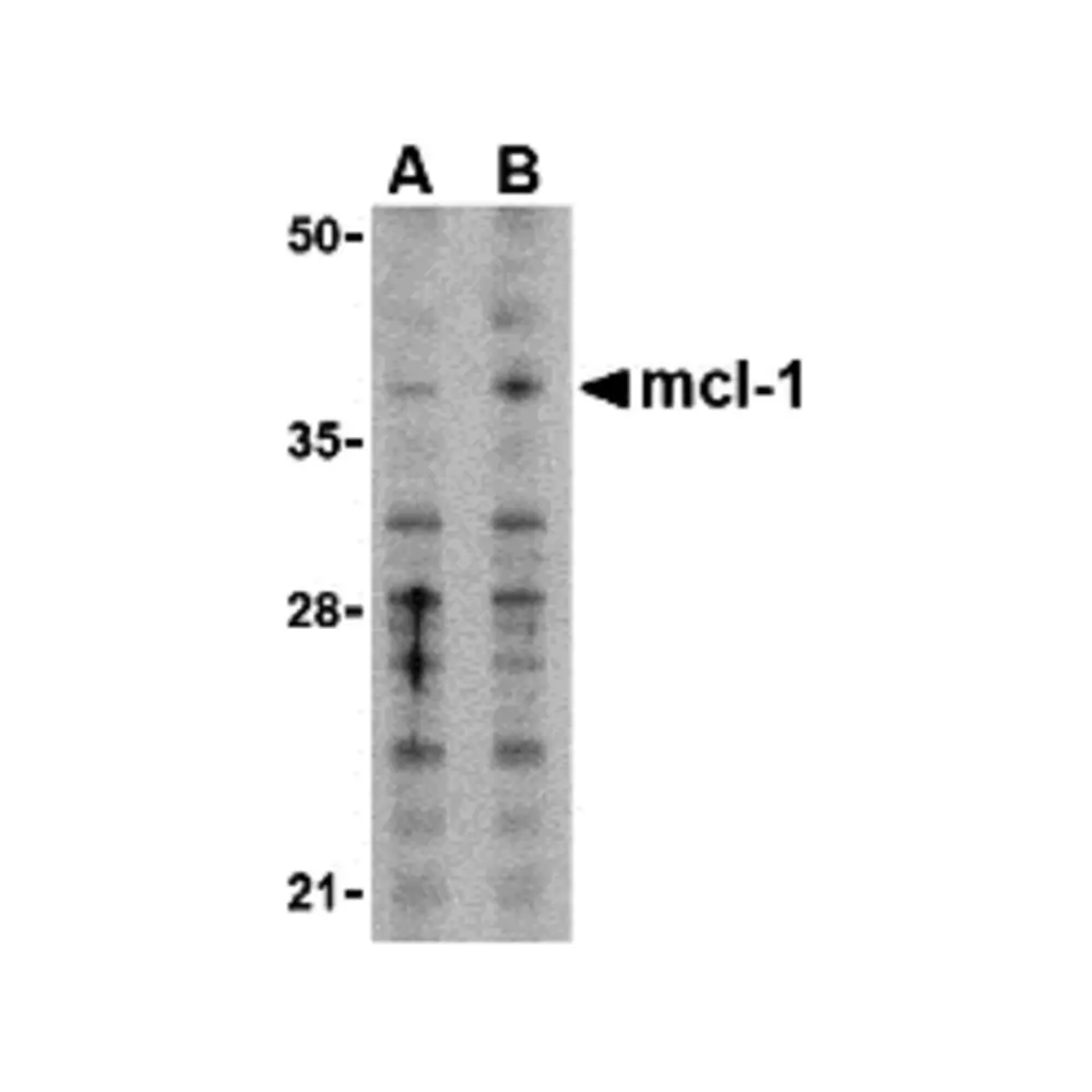 ProSci 3479_S Mcl-1 Antibody, ProSci, 0.02 mg/Unit Primary Image