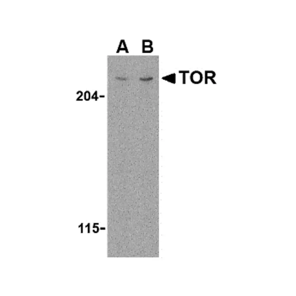ProSci 3485 TOR Antibody, ProSci, 0.1 mg/Unit Primary Image
