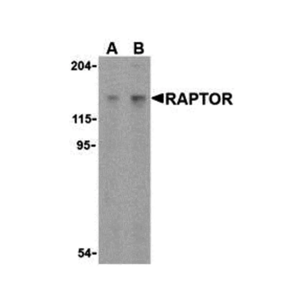 ProSci 3489_S Raptor Antibody, ProSci, 0.02 mg/Unit Primary Image