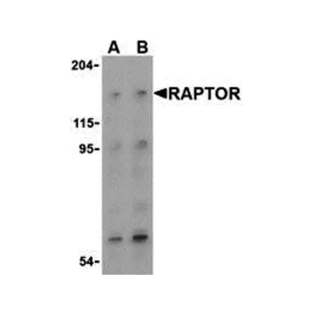 ProSci 3493 Raptor Antibody, ProSci, 0.1 mg/Unit Primary Image