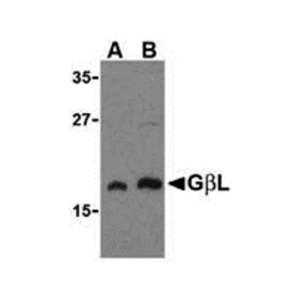ProSci 3495_S GBL Antibody, ProSci, 0.02 mg/Unit Primary Image