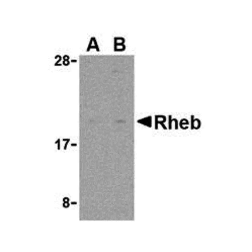 ProSci 3499 Rheb Antibody, ProSci, 0.1 mg/Unit Primary Image