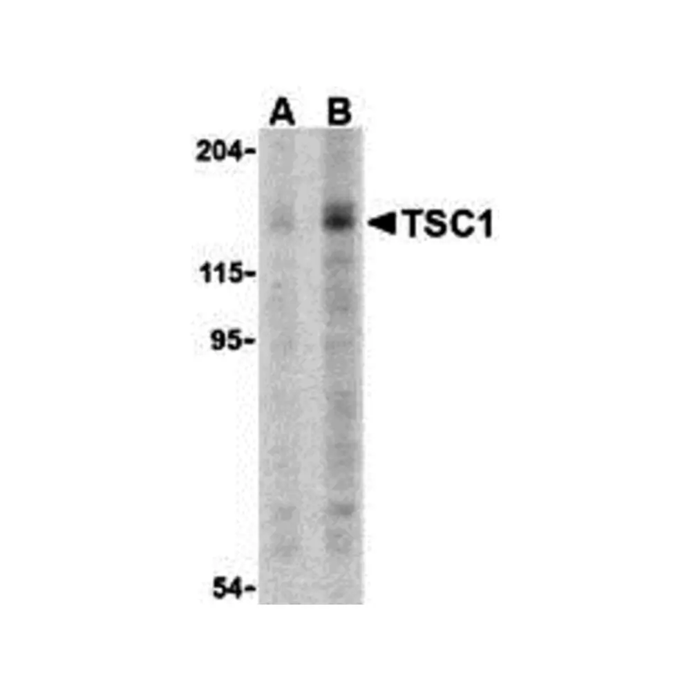 ProSci 3503_S TSC1 Antibody, ProSci, 0.02 mg/Unit Primary Image