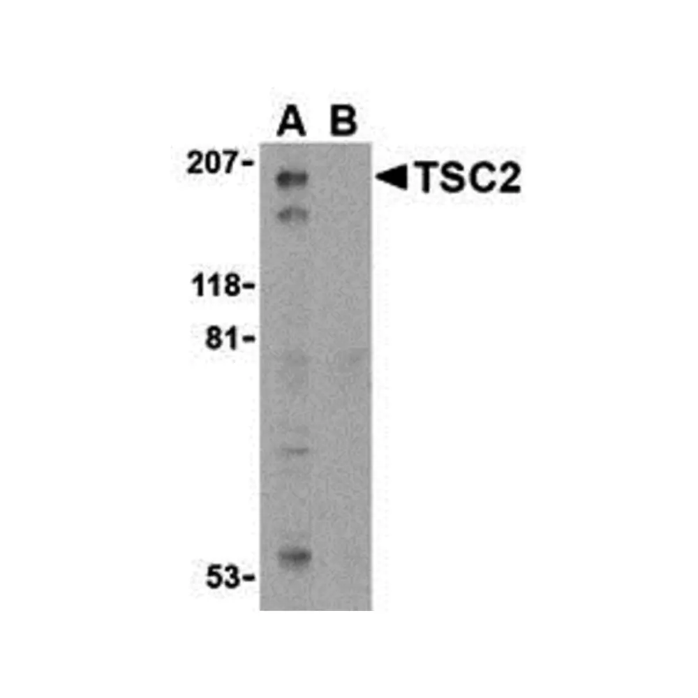 ProSci 3507_S TSC2 Antibody, ProSci, 0.02 mg/Unit Primary Image