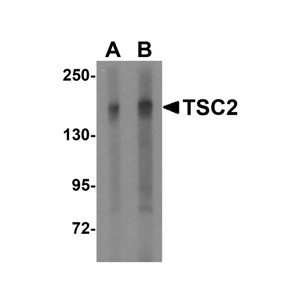 ProSci 3509_S TSC2 Antibody, ProSci, 0.02 mg/Unit Primary Image