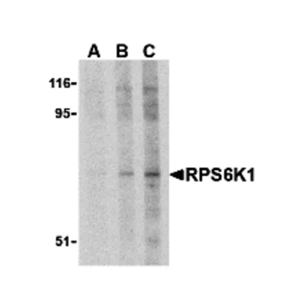 ProSci 3511 RPS6K1 Antibody, ProSci, 0.1 mg/Unit Primary Image