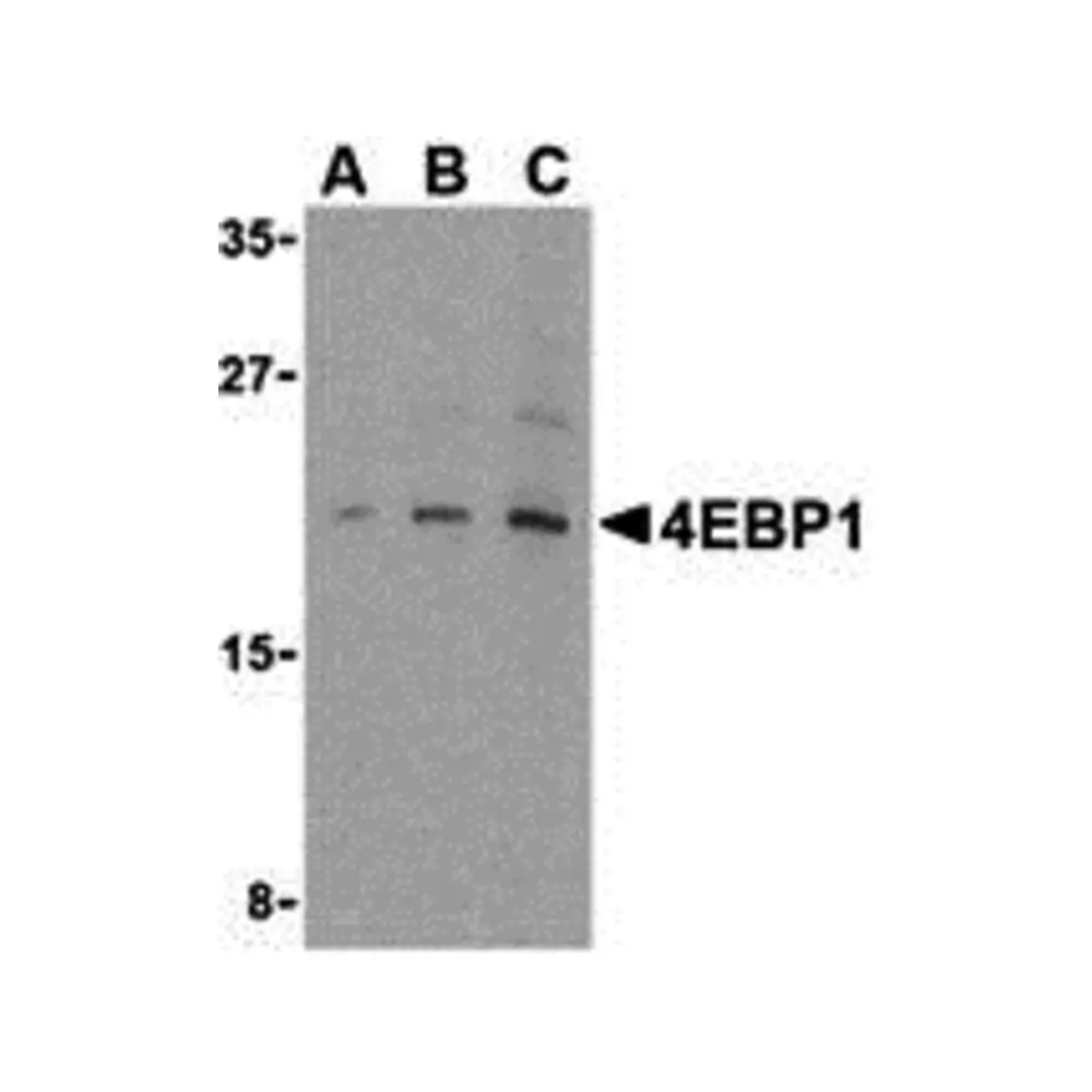 ProSci 3513 4E-BP1 Antibody, ProSci, 0.1 mg/Unit Primary Image
