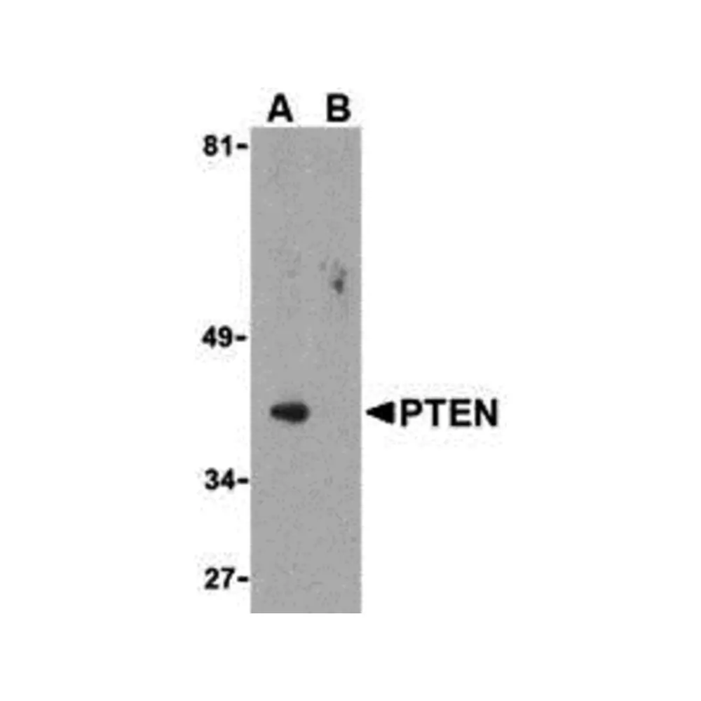 ProSci 3515 PTEN Antibody, ProSci, 0.1 mg/Unit Primary Image
