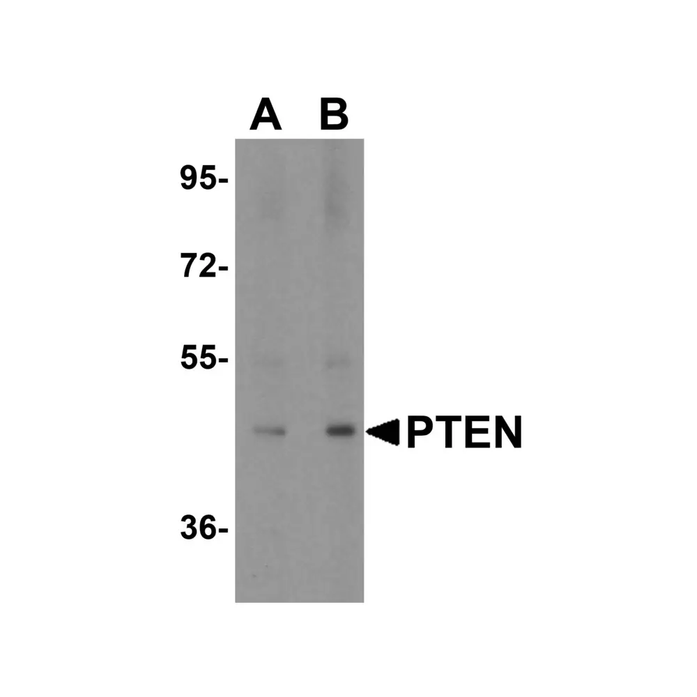 ProSci 3517 PTEN Antibody, ProSci, 0.1 mg/Unit Primary Image