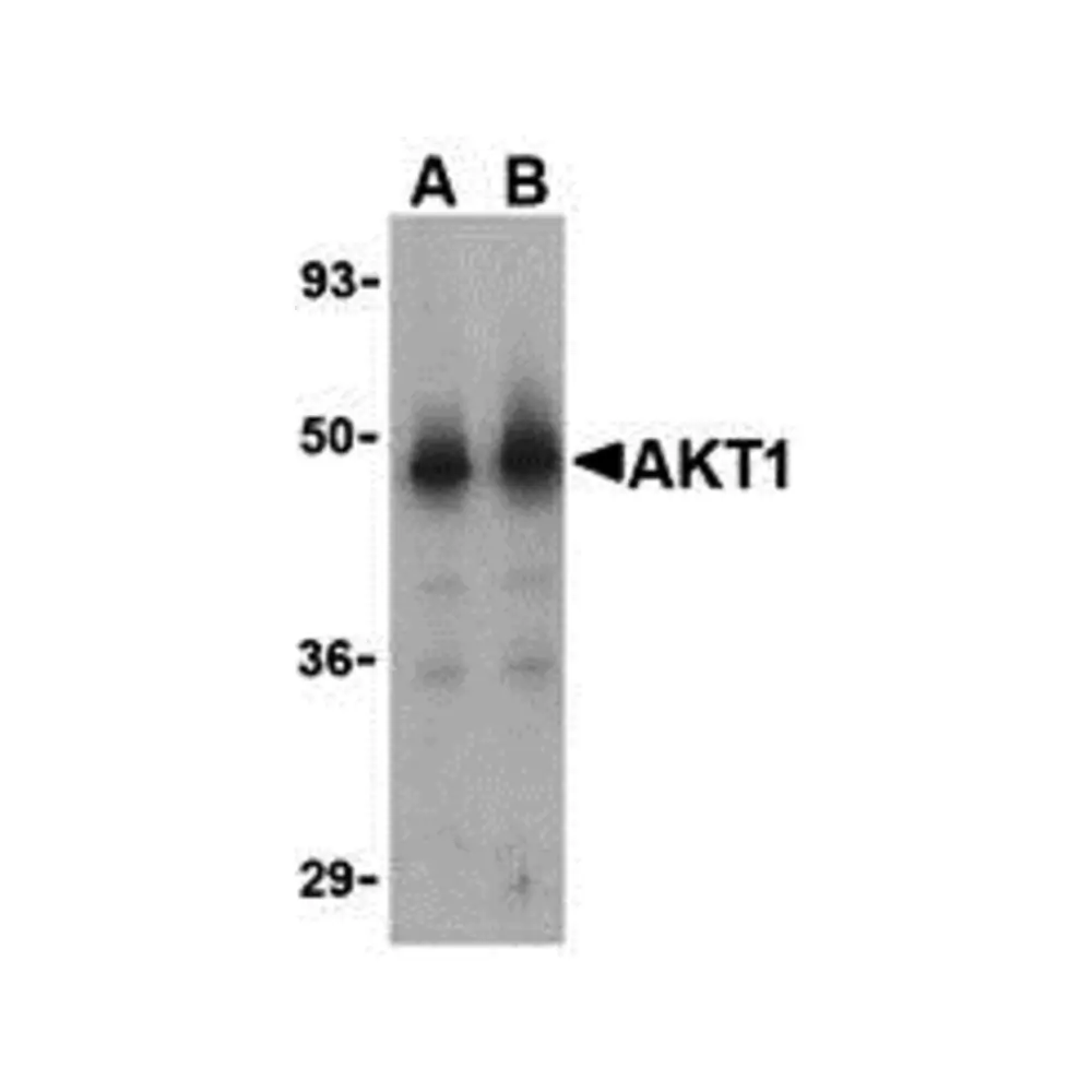 ProSci 3519 Akt1 Antibody, ProSci, 0.1 mg/Unit Primary Image