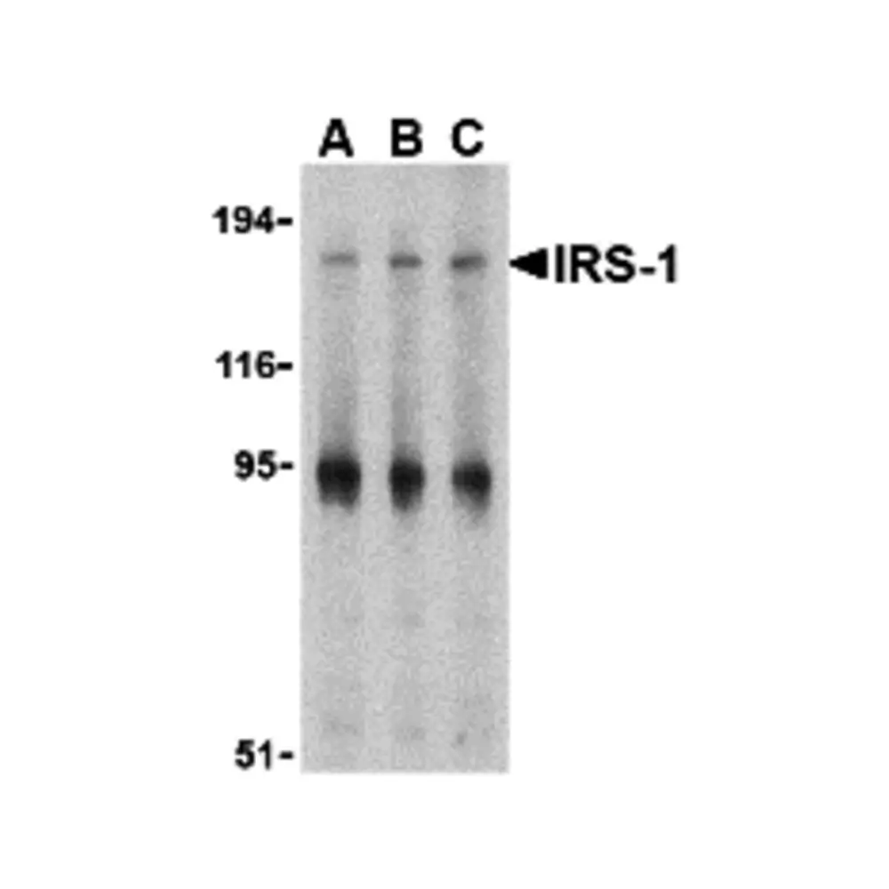 ProSci 3521_S IRS-1 Antibody, ProSci, 0.02 mg/Unit Primary Image