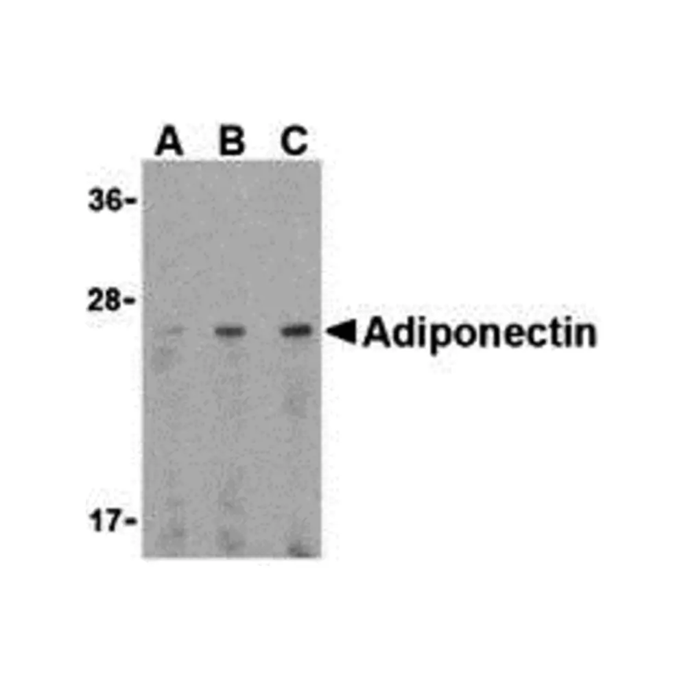 ProSci 3551_S Adiponectin Antibody, ProSci, 0.02 mg/Unit Primary Image