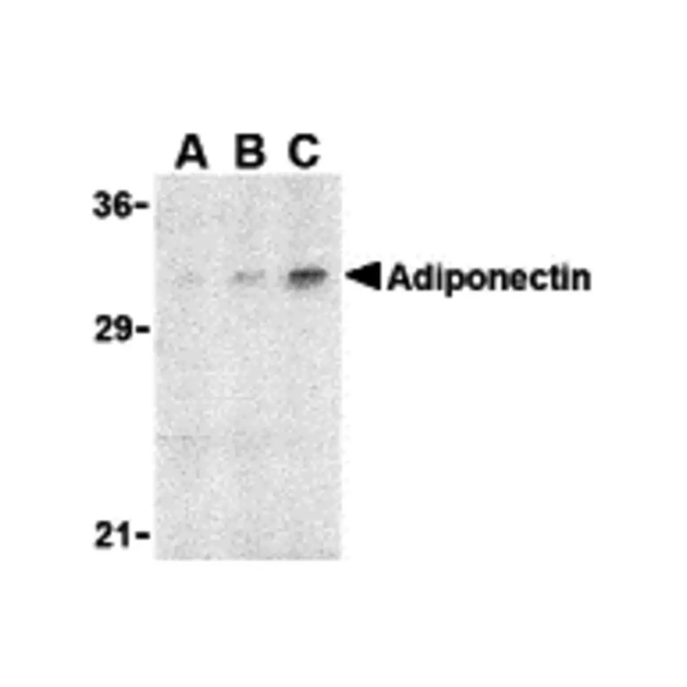 ProSci 3553 Adiponectin Antibody, ProSci, 0.1 mg/Unit Primary Image