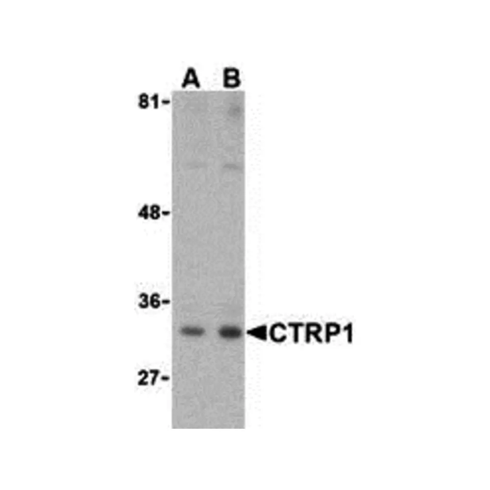 ProSci 3555 CTRP1 Antibody, ProSci, 0.1 mg/Unit Primary Image