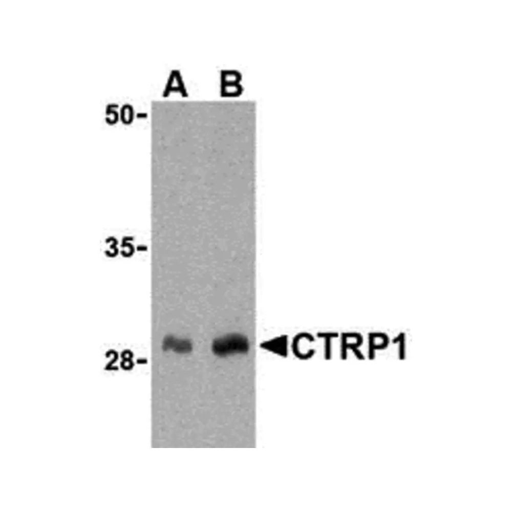ProSci 3557 CTRP1 Antibody, ProSci, 0.1 mg/Unit Primary Image