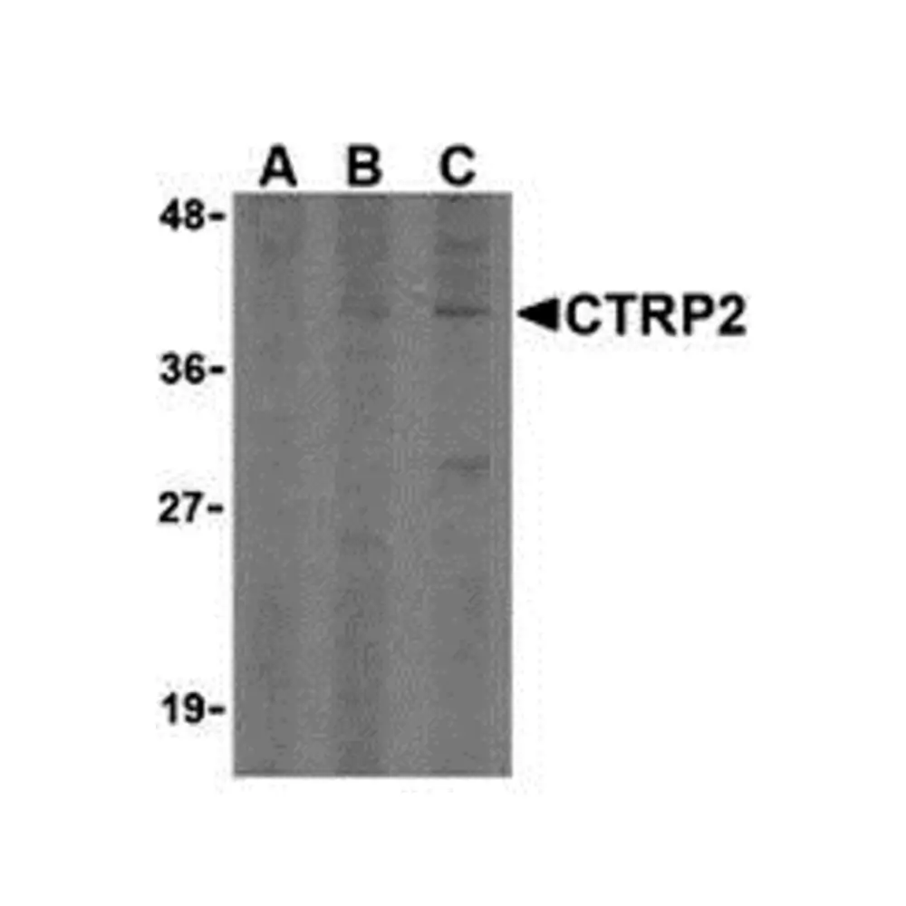 ProSci 3559 CTRP2 Antibody, ProSci, 0.1 mg/Unit Primary Image