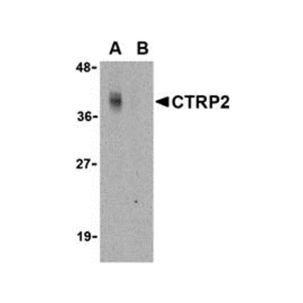 ProSci 3561_S CTRP2 Antibody, ProSci, 0.02 mg/Unit Primary Image