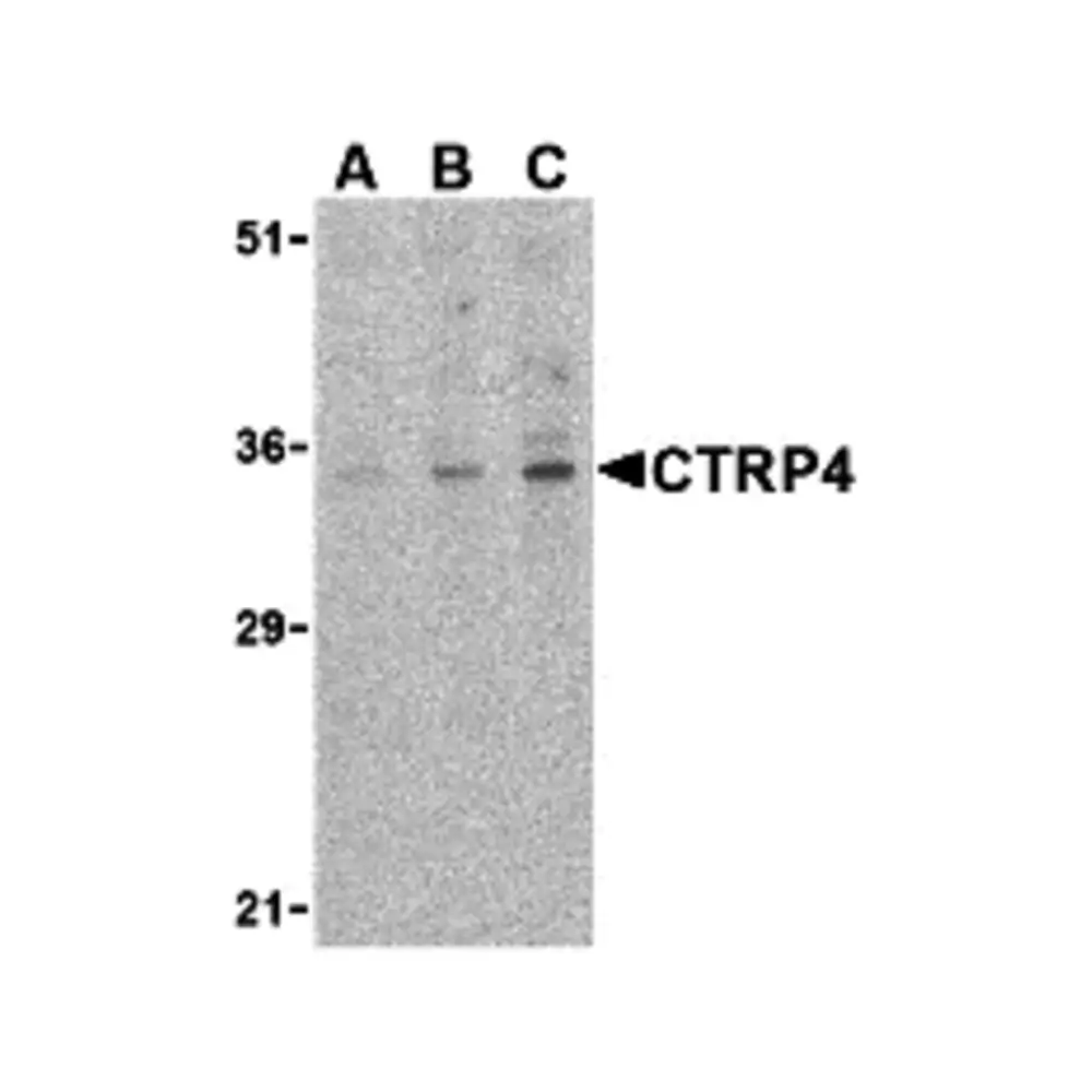 ProSci 3567_S CTRP4 Antibody, ProSci, 0.02 mg/Unit Primary Image