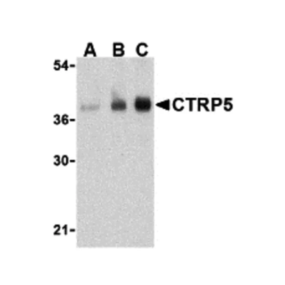 ProSci 3571 CTRP5 Antibody, ProSci, 0.1 mg/Unit Primary Image