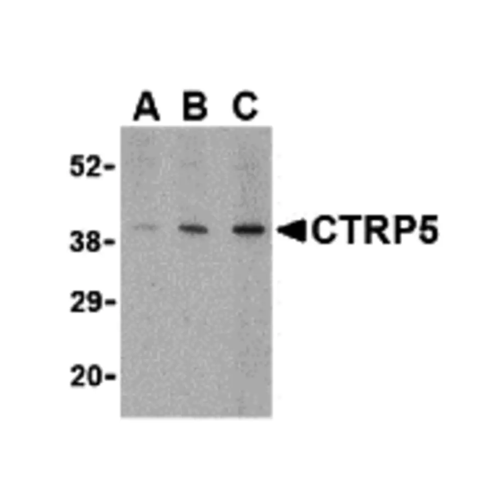ProSci 3573_S CTRP5 Antibody, ProSci, 0.02 mg/Unit Primary Image